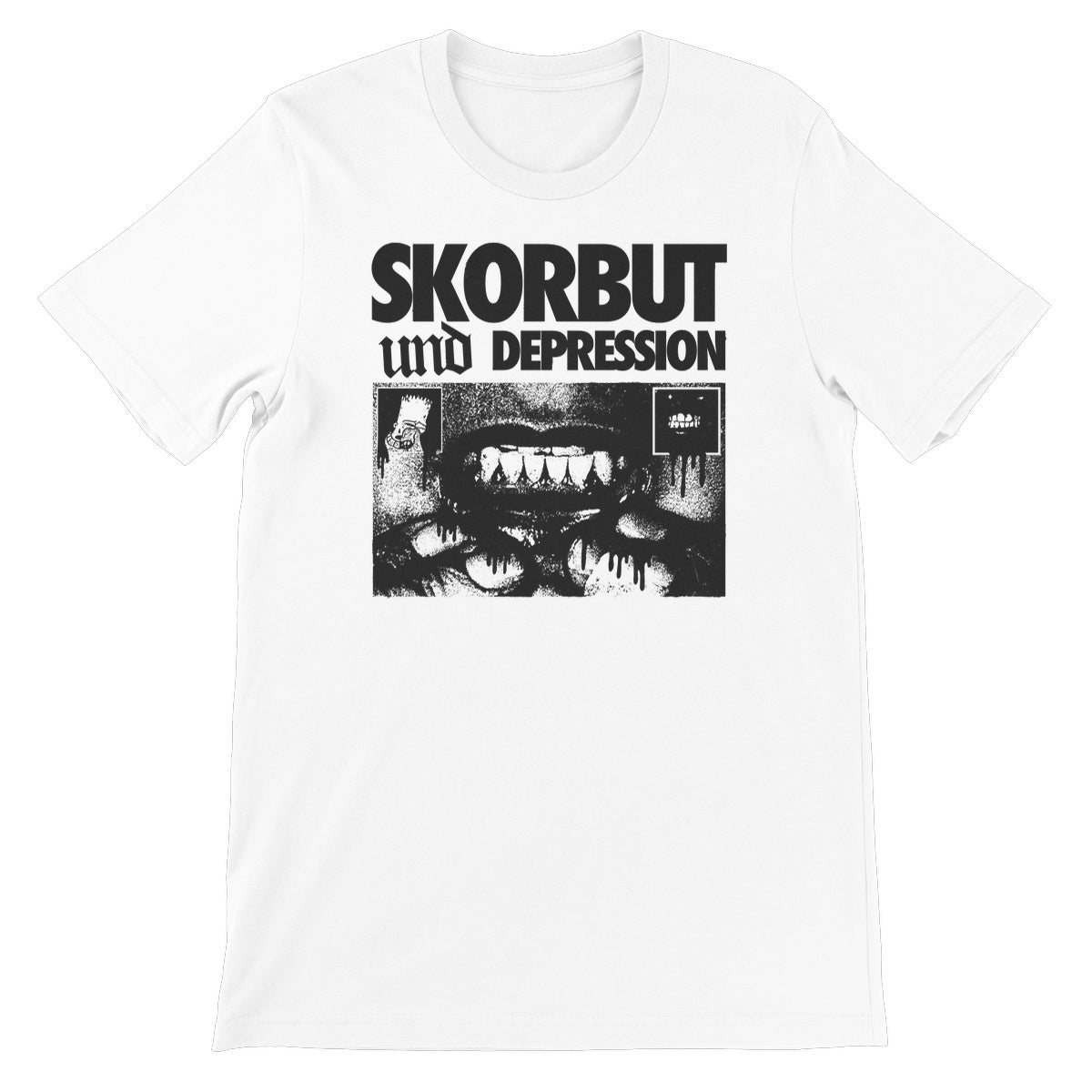 Skorbut und Depression